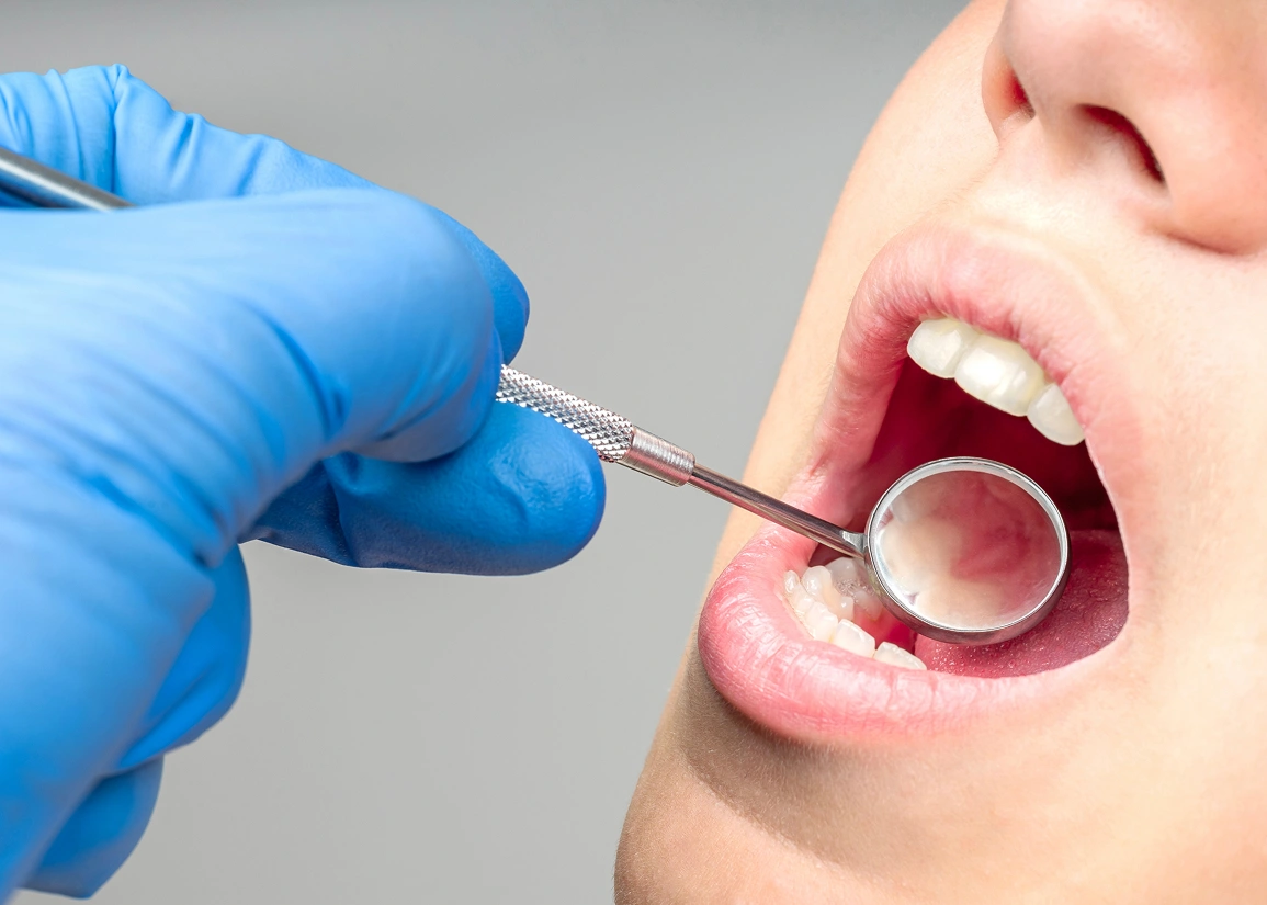 Comprehensive dental exam