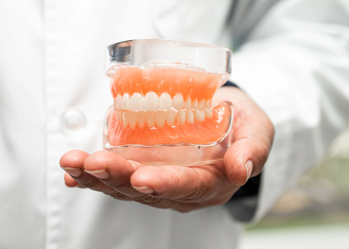 Over denture dental implants
