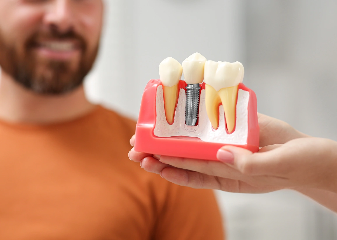 Single dental implant procedure