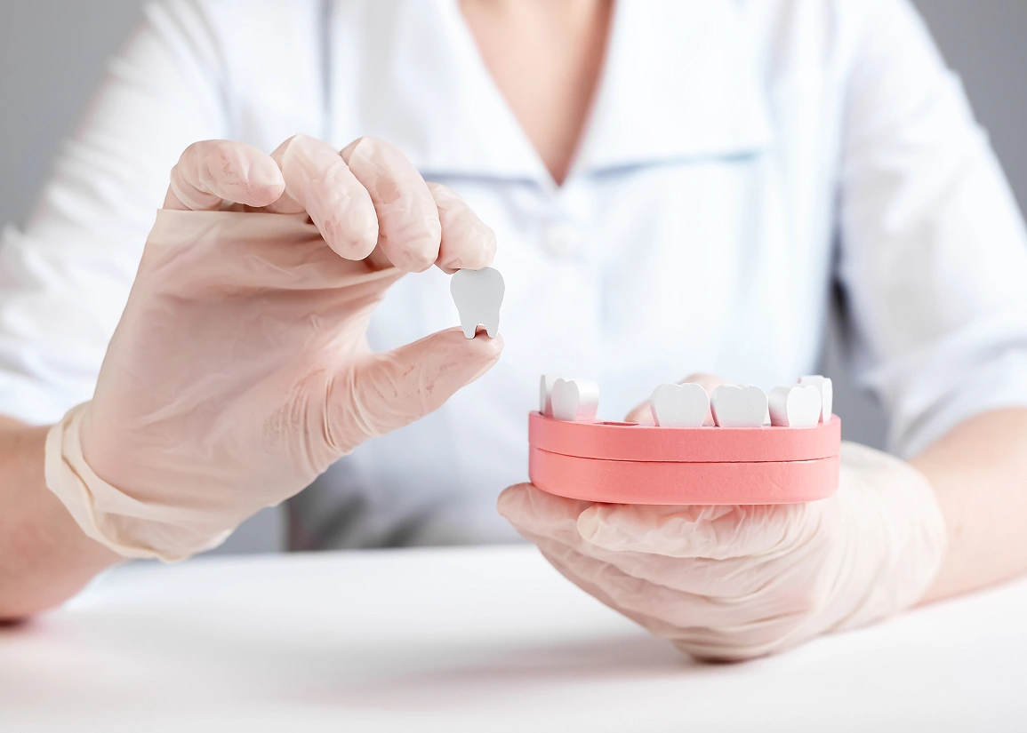 Affordable dental implants